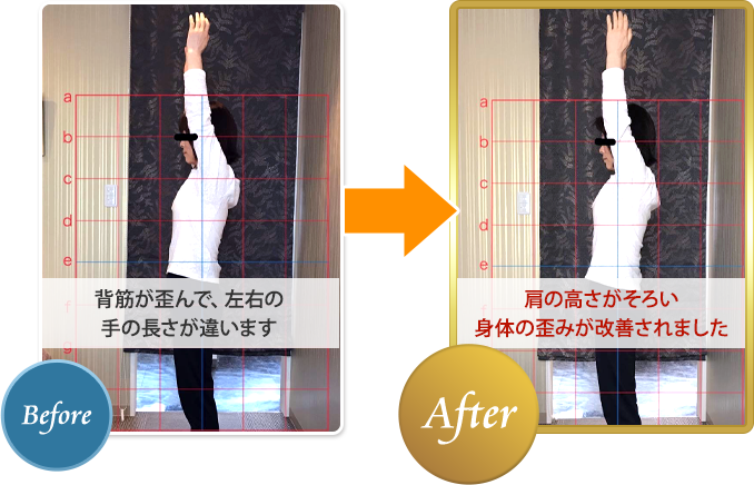 身体の歪みが改善されました